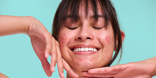 Proactiv